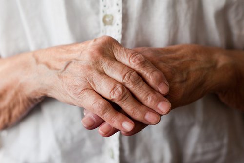 Artritis reumatoide ataca a dos mujeres por cada hombre