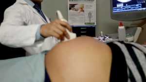 Asciende a 150 los casos de embarazadas con el virus del zika