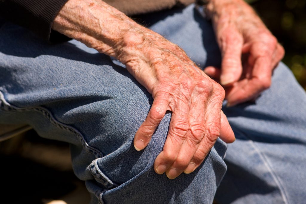 Enfermedad de Parkinson golpea con mayor fuerza a hombres que a mujeres