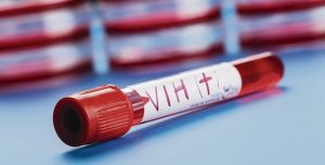 CCSS garantiza normalización de medicamento contra VIH a partir de este martes