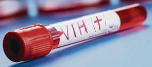 CCSS llama a población sexualmente activa a realizarse prueba por infección VIH