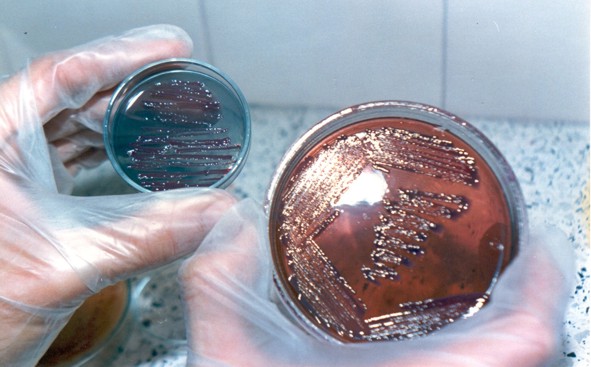 CCSS creó comisión técnica para investigar presencia de bacteria en Calderón Guardia