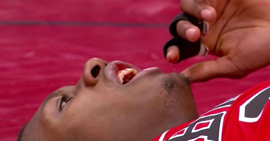 ¡Qué dolor! La fea caída de un basquetbolista que terminó con dos dientes menos