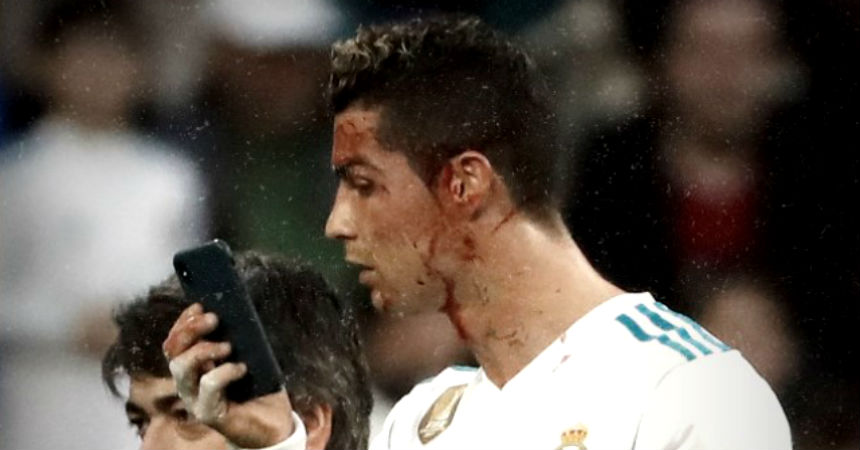 El día después: así quedó el rostro de Cristiano Ronaldo