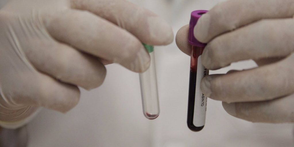Salud pide realizarse prueba VIH gratuita y confidencial: 816 casos diagnosticados en 2023