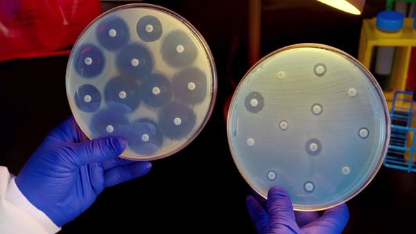 Bacteria mata a embarazada y envía a doctor a cuidados intensivos en Heredia