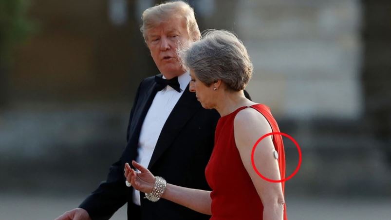 Qué es el dispositivo blanco que lleva Theresa May en el brazo