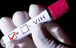 En 15 años más de 10 mil costarricenses fueron diagnosticados con VIH