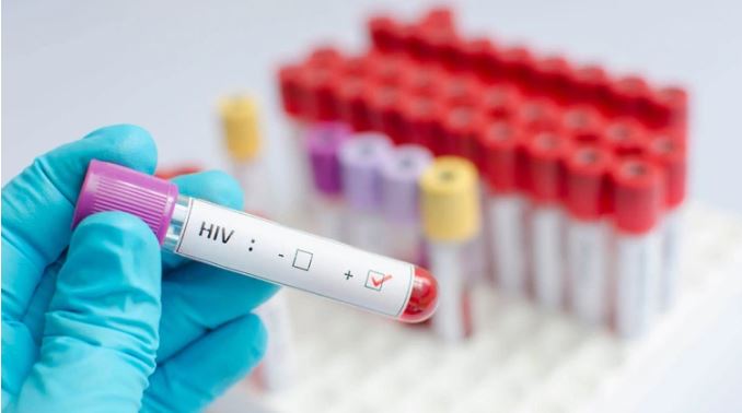Un estudio francés descubrió una fórmula que permite eliminar el virus del VIH