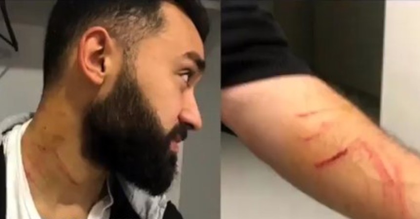¿Futbolista o delincuente?: jugador agredió a sus rivales con un cuchillo en pleno partido