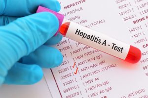 Ministerio de Salud identifica brote de Hepatitis tipo A: Se trata de nueve casos confirmados
