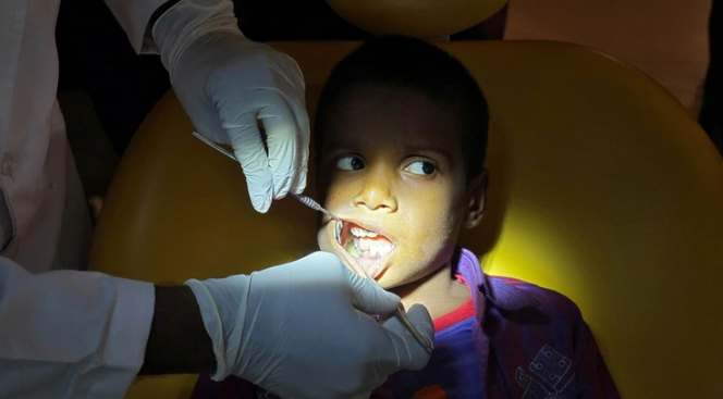 Médicos indios extrajeron más de 500 dientes de la boca de un niño
