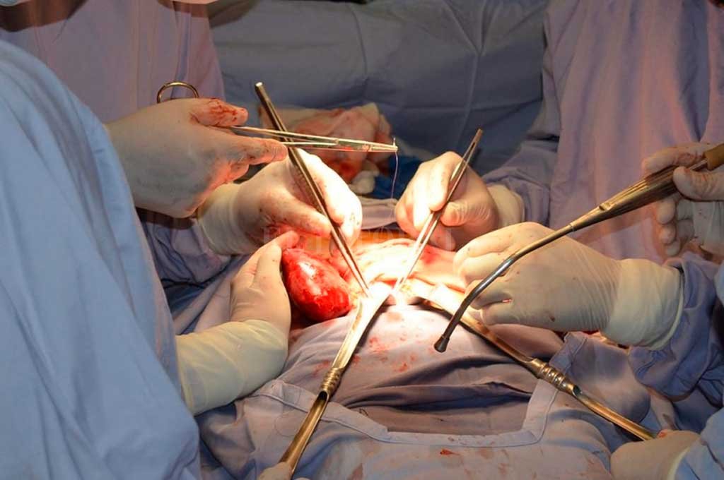 Hospital México alcanza un 97% de éxito en trasplante renal