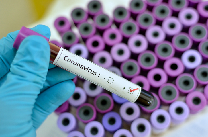 Casos del nuevo coronavirus aumentan a 69: Pacientes son de 25 cantones del país