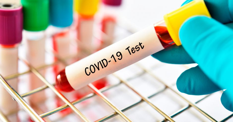 Estudio respalda pruebas aplicadas por Costa Rica para detectar Covid-19 por encima de países desarrollados