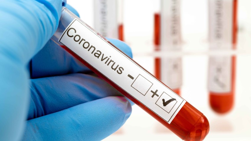 Científicos estudian sangre de pacientes graves con Covid-19 para mejorar su tratamiento