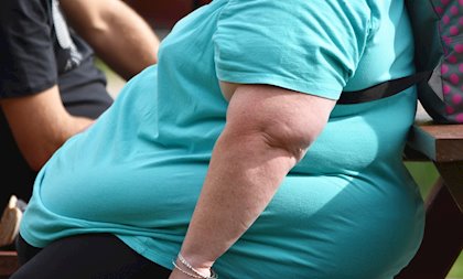 Especialista alerta riesgo por Covid-19 que enfrentan las personas con obesidad
