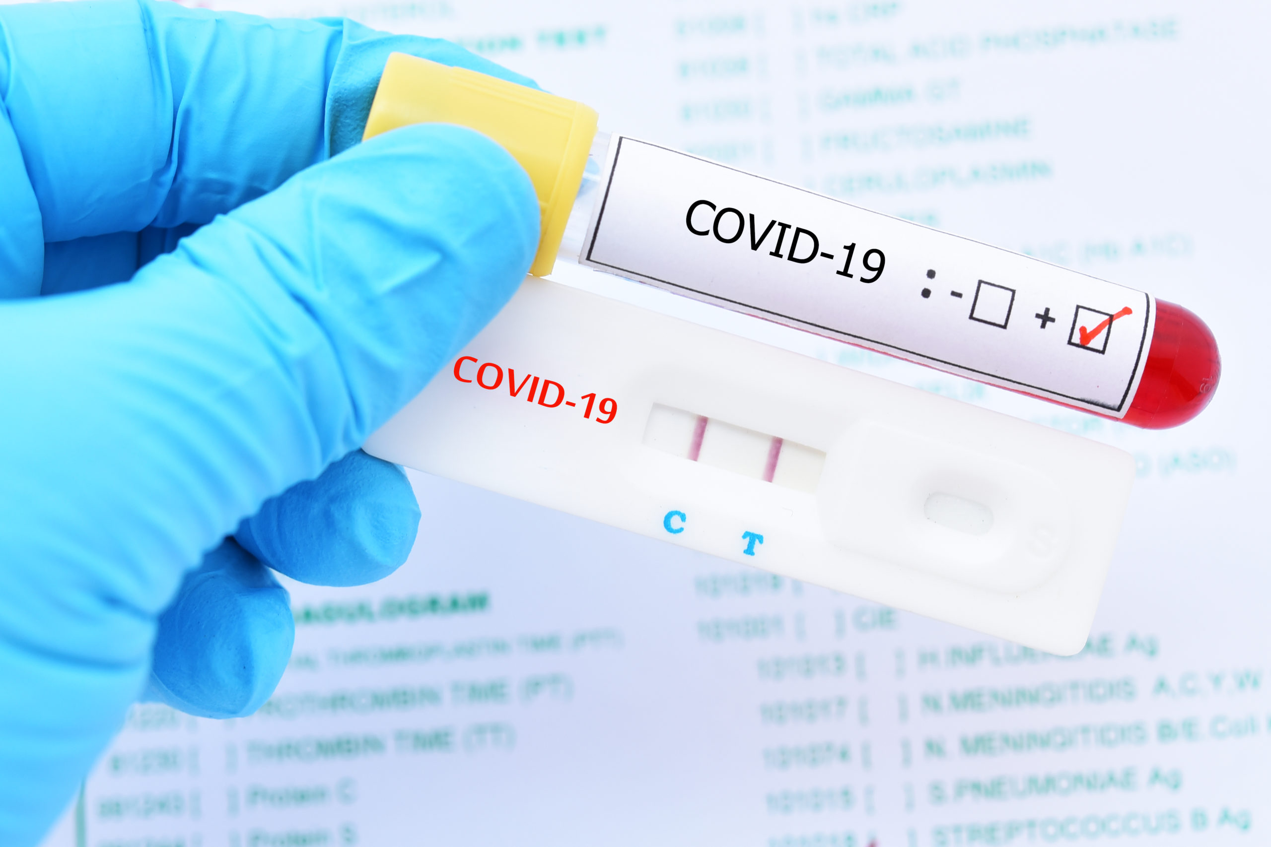 Microbiólogos piden facilitar ingreso de reactivos para que sector privado mida inmunidad de Covid-19