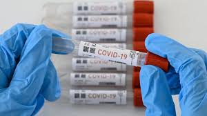 Salud avala uso de pruebas que miden anticuerpos en personas expuestas al Covid-19