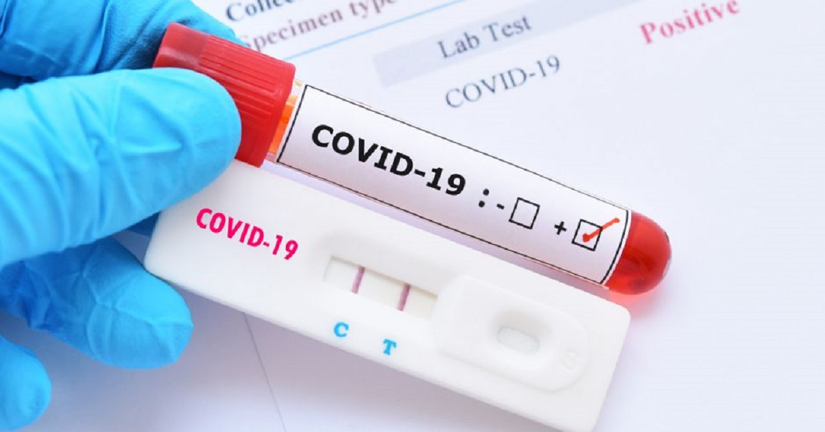 Seis meses de pandemia: Costa Rica cerca de los 47 mil casos acumulados de Covid-19