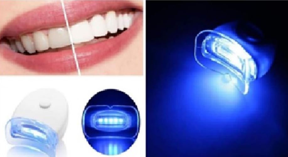 Salud advierte sobre blanqueadores dentales sin registro sanitario promocionados en redes sociales