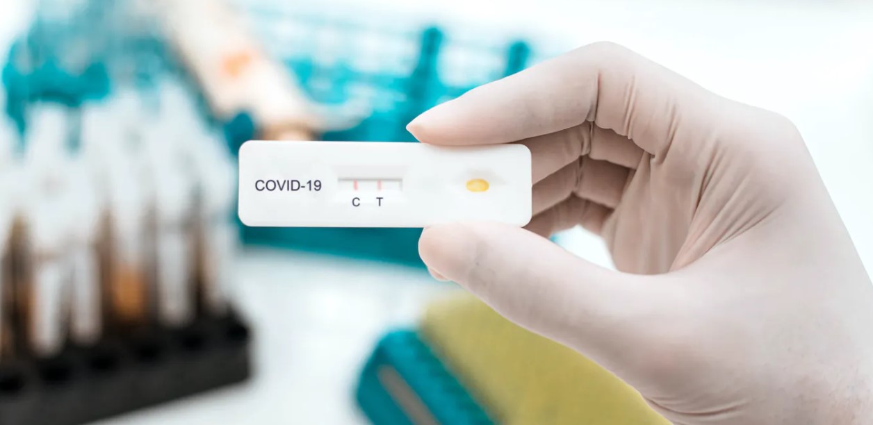 Presionan a la CCSS para que aplique pruebas de antígenos para detectar el Covid-19