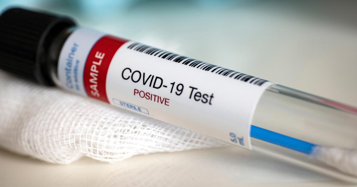 COVID-19: Informe revela que fuerza de la pandemia se trasladó a las zonas costeras