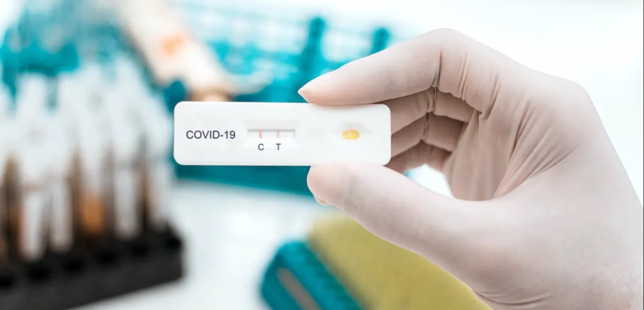 14 áreas de salud y hospitales se sumarán próximamente a detección del Covid-9 por pruebas de antígeno