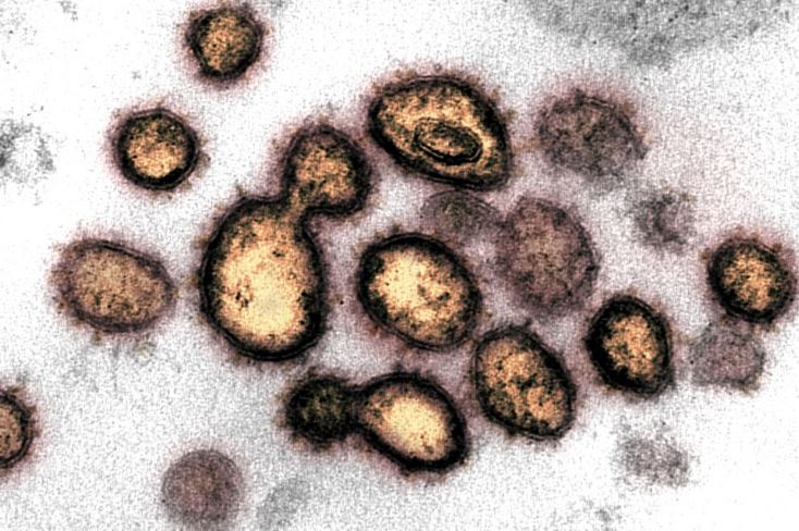 El camino hacia las pandemias: informe de ONU advierte sobre 1,7 millones de virus aún no descubiertos
