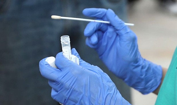 Unión Médica pide obligatoriedad de prueba PCR a turistas tras detección de variante Delta