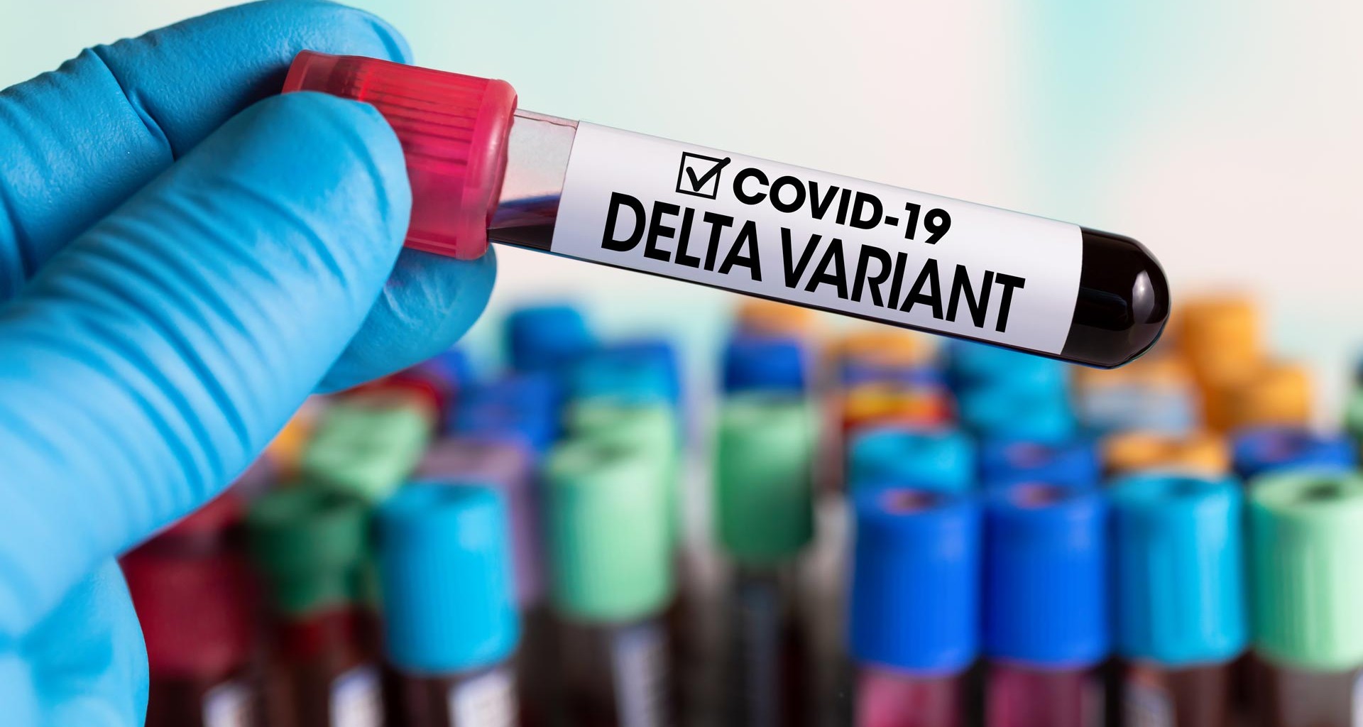 Costa Rica registra 104 casos de variante Delta del Covid-19 detectados