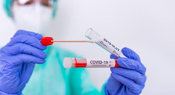 Epidemiólogos piden ampliar capacidad de pruebas para detectar Covid-19 y solicitar carnet sanitario a turistas