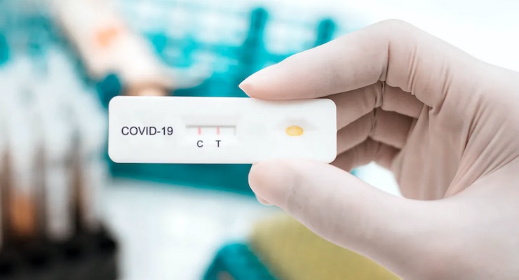 Venta de pruebas rápidas para detectar el Covid-19 aumentó un 20% en últimas semanas