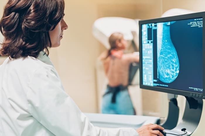 CCCS reconoce faltante de especialistas para reducir listas de espera de mamografías: Convenio con el INS es la esperanza
