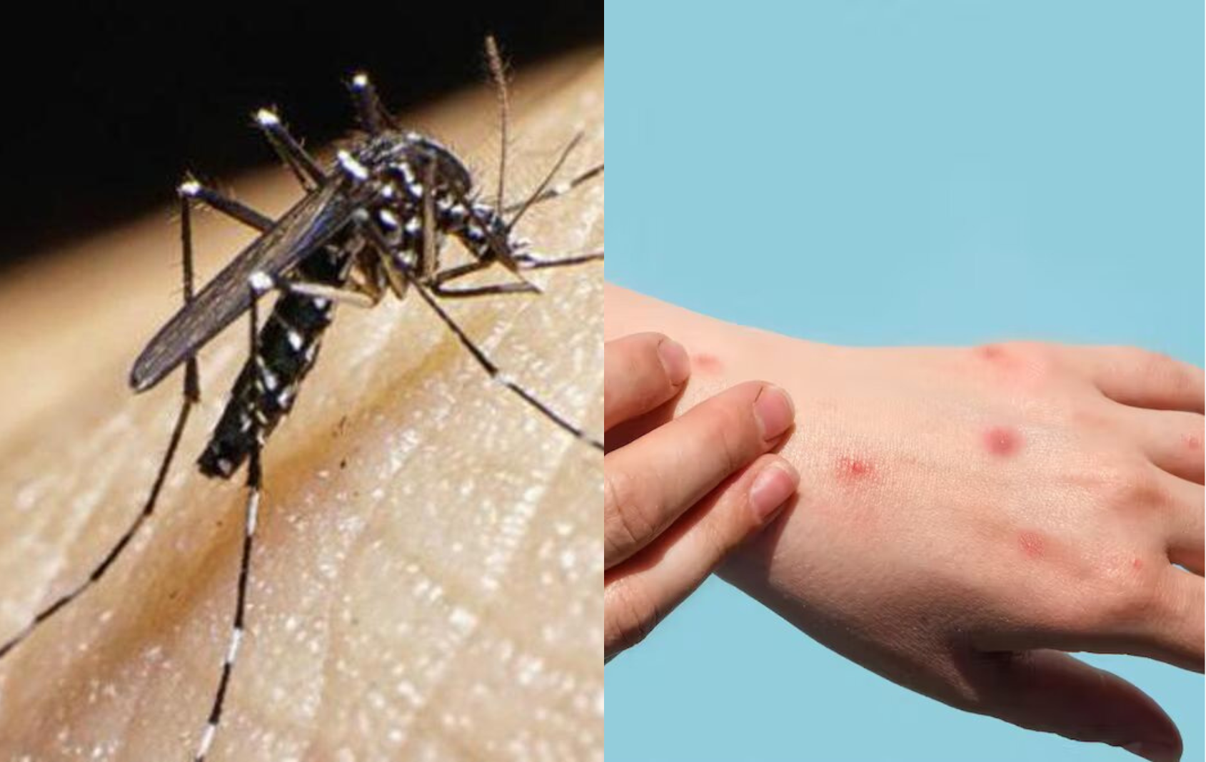 Salud ha detectado 7 casos de viruela símica y 3 de dengue tipo cuatro en la última semana