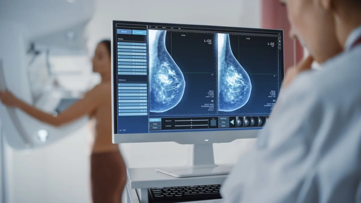 CCSS: Lista de espera de mamografías está en cero; 15 mil están pendientes de resultados