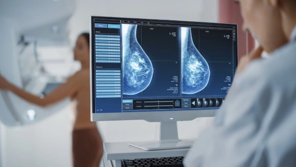 CCSS confirma que 9 de cada 10 mamografías pendientes ya se realizaron