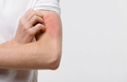 Estudio revela que estrés puede aumentar dermatitis en 5 de cada 10 personas con esta enfermedad