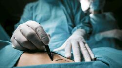 Cirugías gástricas para salvar vidas de personas con obesidad crecieron en 155% durante el 2023